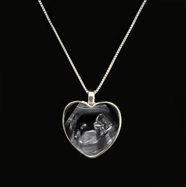 BABY SONOGRAM Heart Shaped Necklace