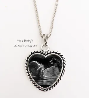 BABY SONOGRAM Necklace, rope heart design
