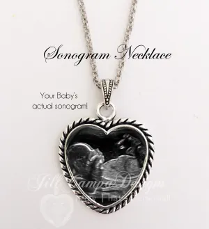 Sonogram Necklace, rope heart shape, Your baby's sonogram on a necklace
